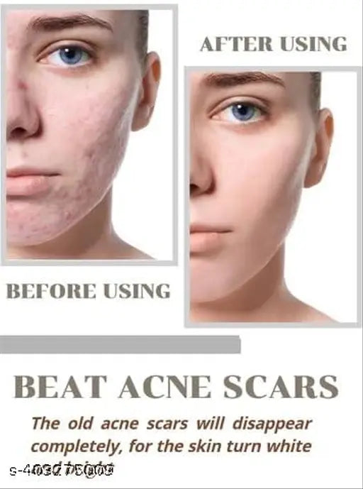 Niacid Face Serum -Skin Brightening & Anti-Aging Formula Repairs and Hydrates (Pack of 1)