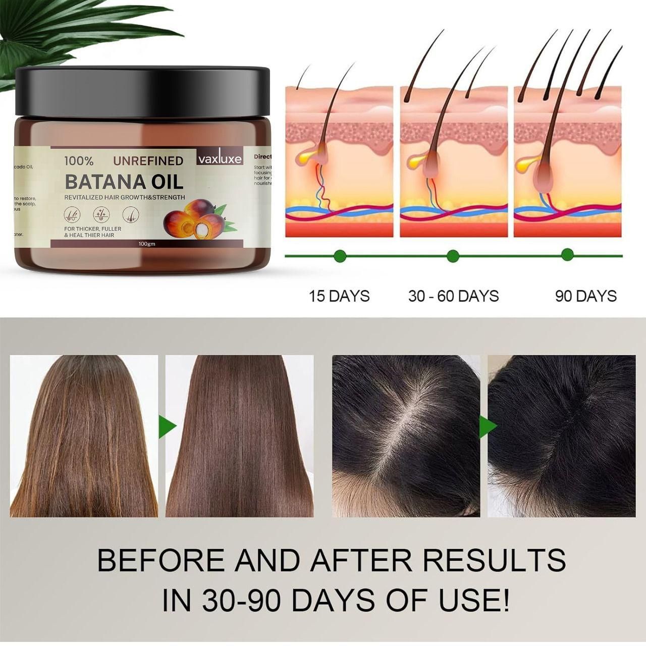 Batana Oil Revitalized Hair Growth & Strength 100 gm Pack of 1